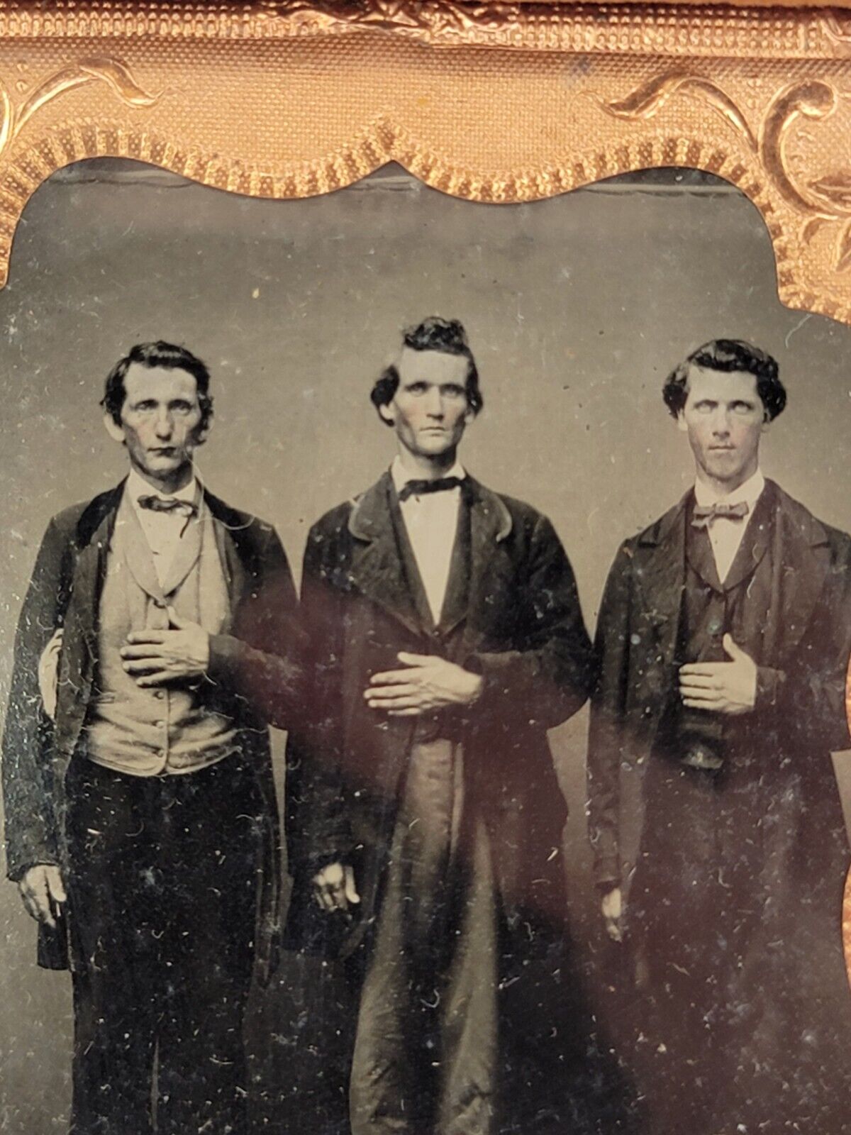 Original Antique 1800\'s Photograph of 3 Men in Gutta Percha Case - Head Wound?
