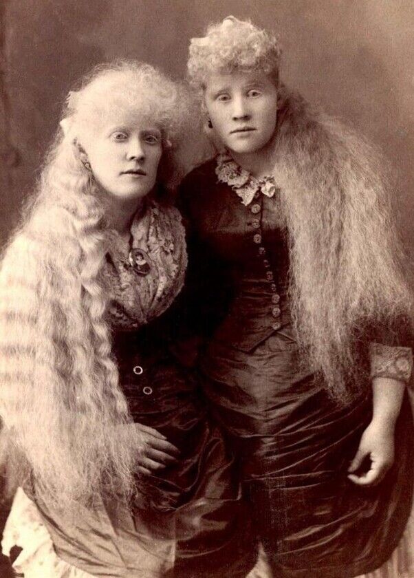 Antique Circus Albino Sisters Photo 1212 Oddleys Strange & Bizarre