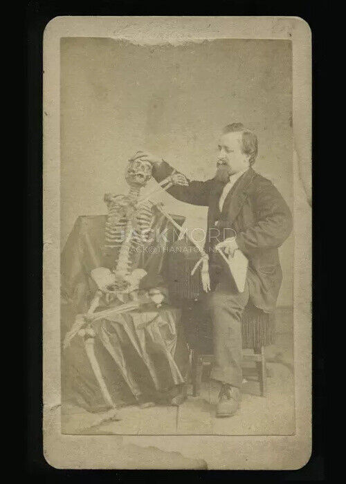 Rare CDV Photo Man / Doctor Taking Temperature of Human Skeleton Antiques 1800s