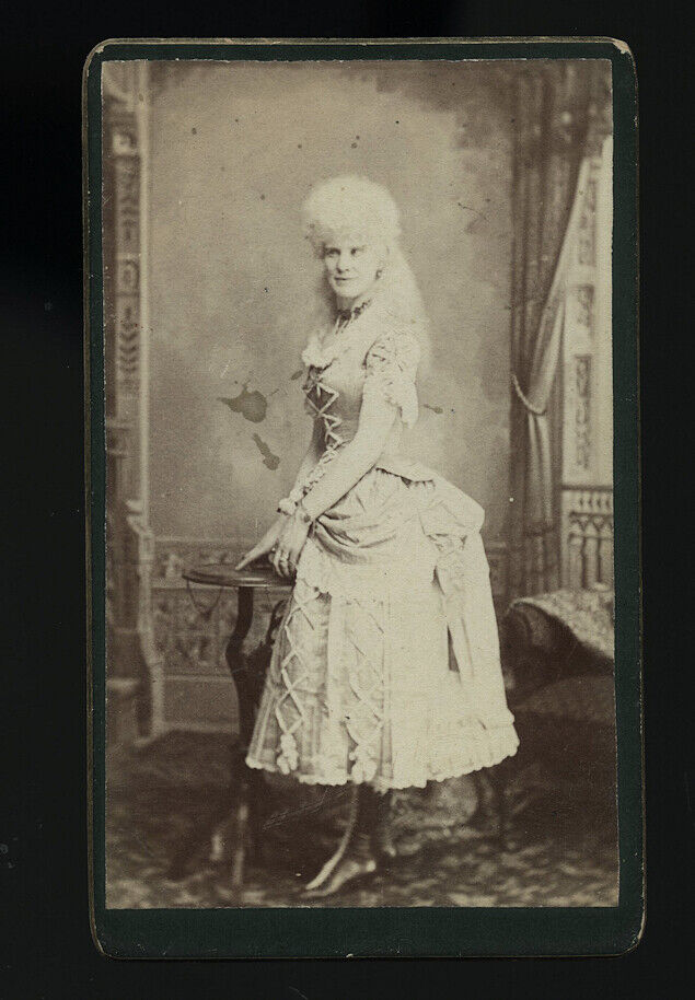 Albino Girl - Victorian Sideshow Personality, 1800s CDV Photo Barnum Freak