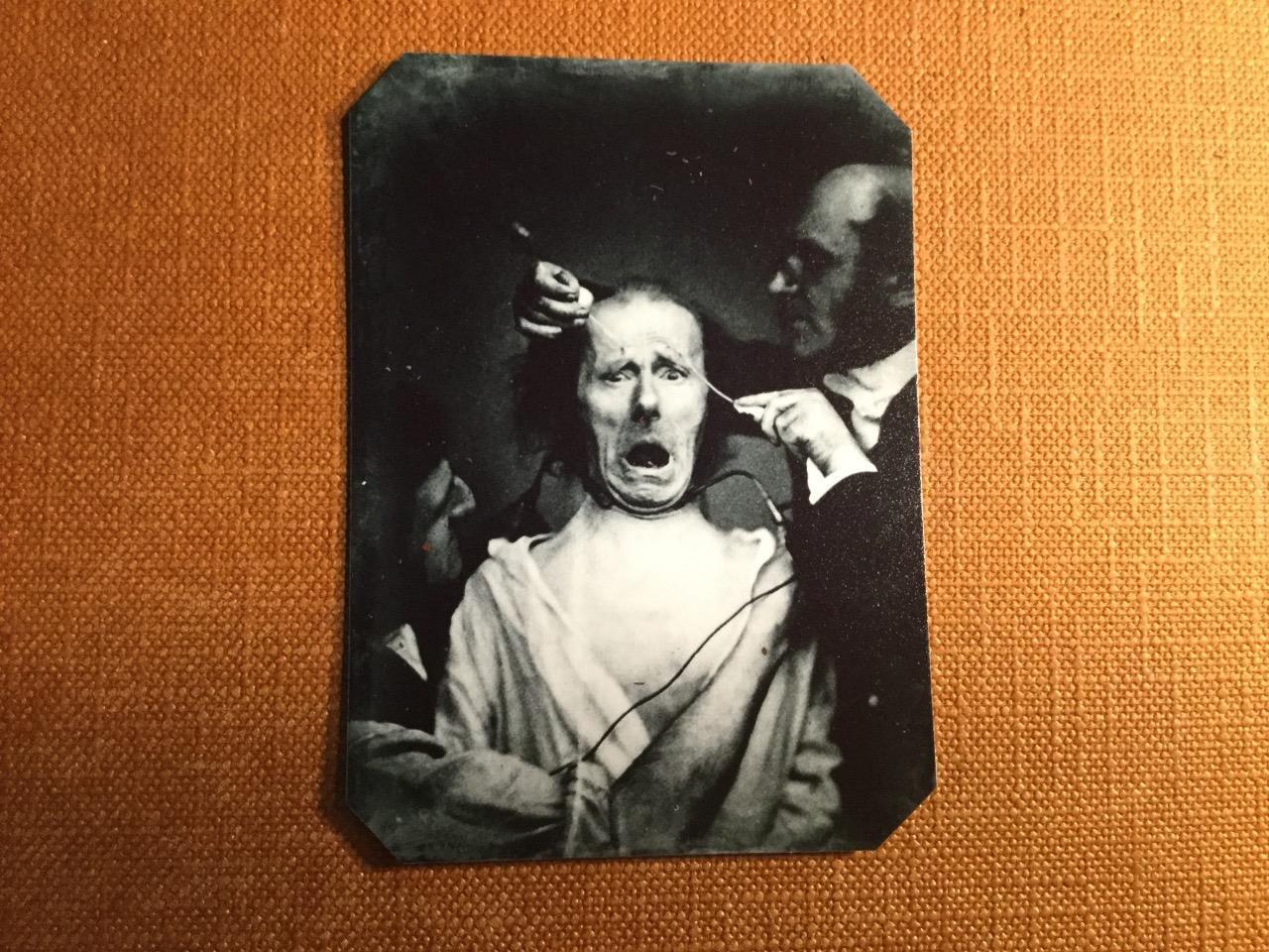 Unusual-Bizarre-Unique-Interesting-Medical Electro-Physiology RP tintype C388RP