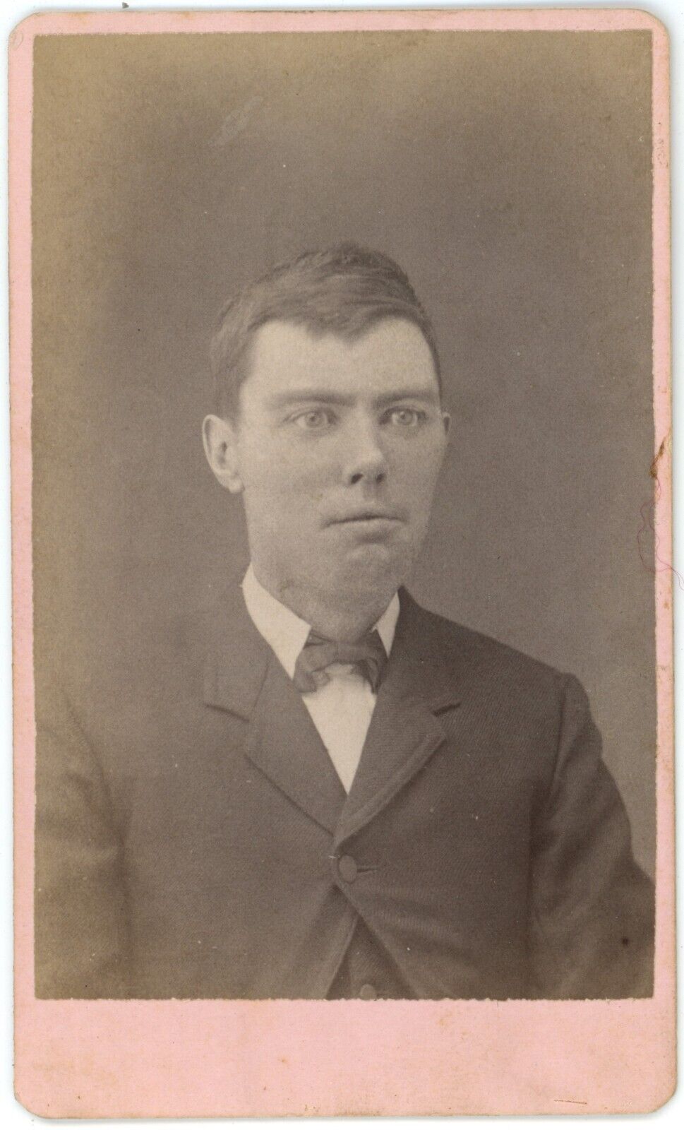 CIRCA 1880\'S ANTIQUE CDV OF ODD LOOKING YOUNG MAN IN SUIT AND BOW TIE