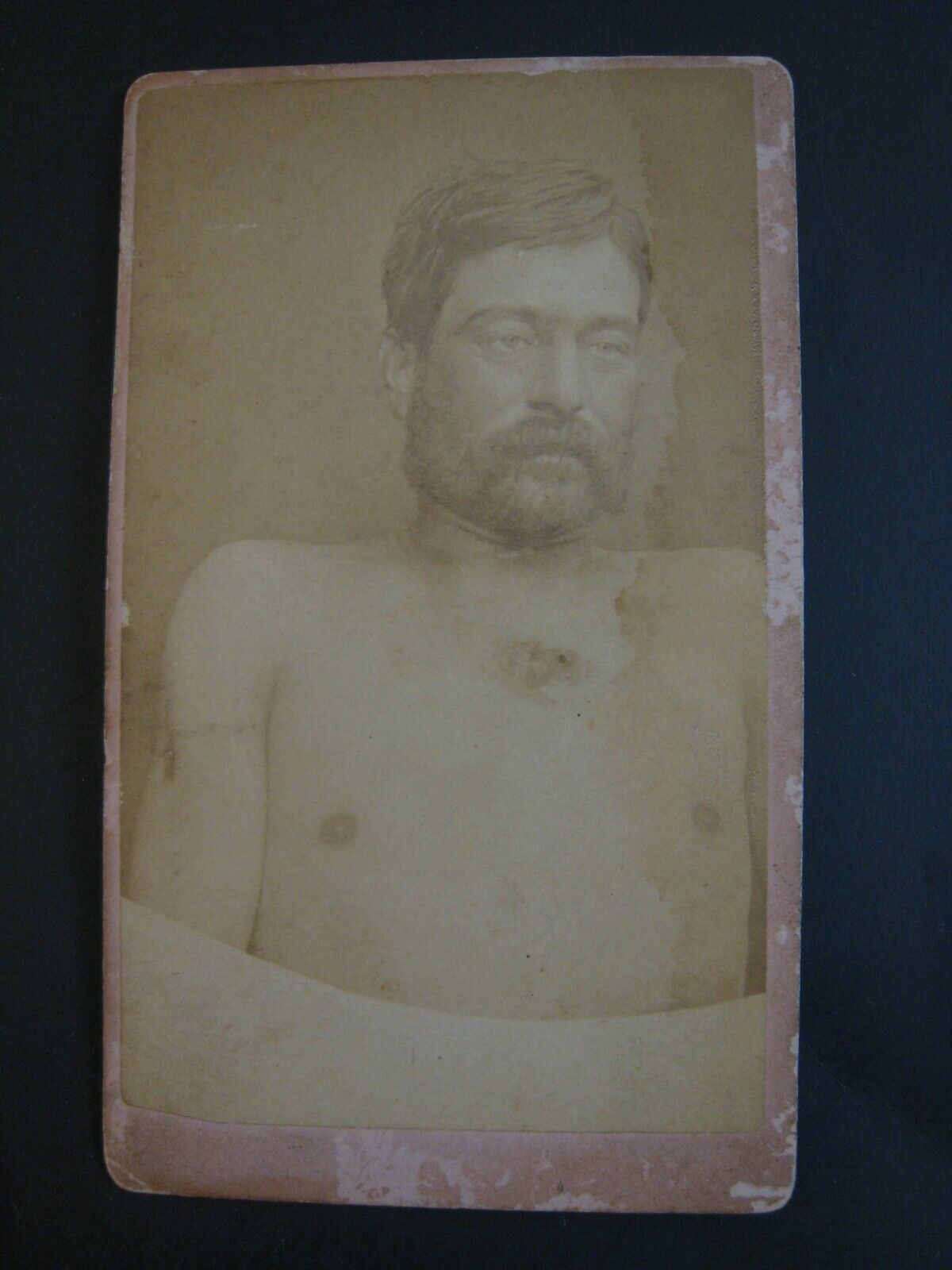 SCARCE, Original 1876 CDV Photo ... JESSE JAMES GANG MEMBER .. OLD WEST OUTLAW