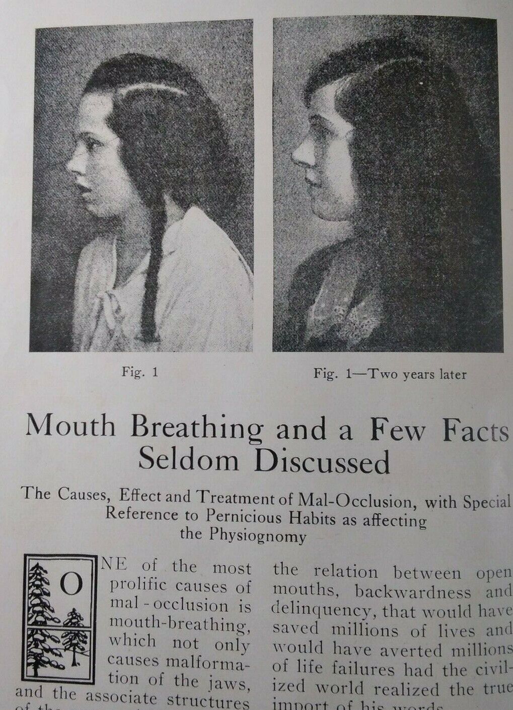 Dentist Antique Medical Booklet Vtg 1922 Mouth Breathing Problems Pics Rare VHTF