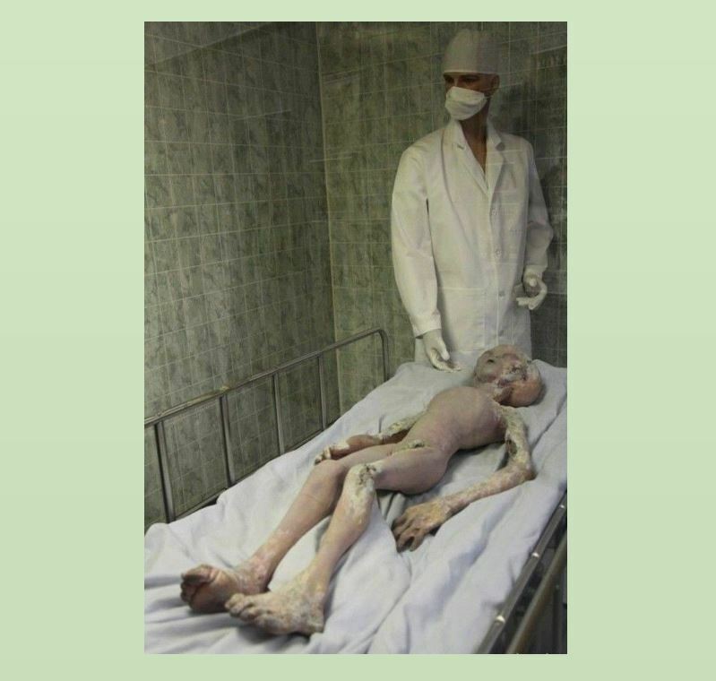 Vintage Creepy Alien Autopsy PHOTO Scary Weird X-Files Body Area 51 UFO Roswell
