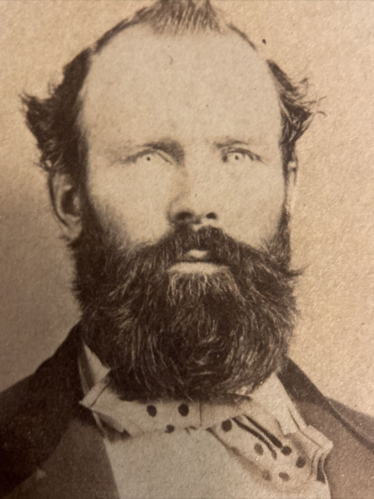 CDV Photo Man With Beard Circa 1880's