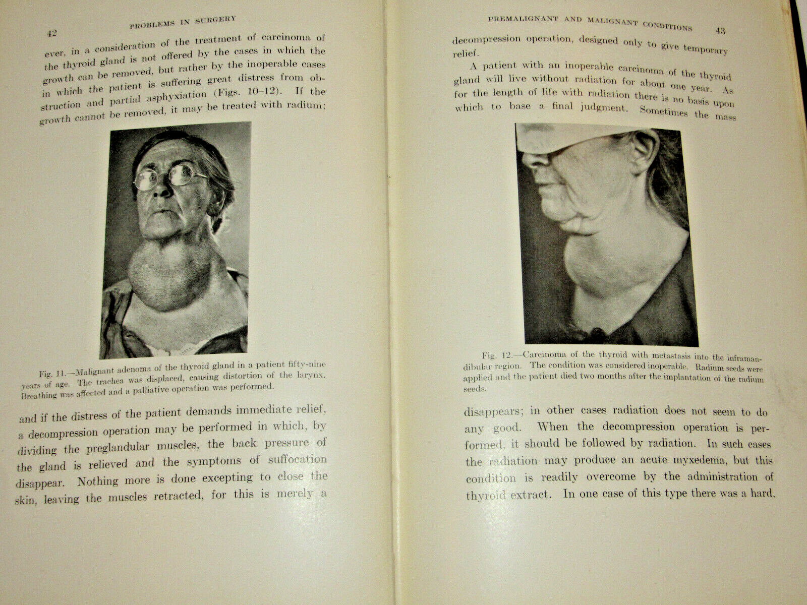 1928 'PROBLEMS IN SURGERY' BOOK GEORGE W CRILE, MD 49 ILLUSTRATIONS LECTURES