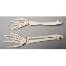 Skeletons and More SM372DL Left Forearm picture