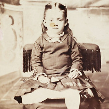 Down Syndrome Girl CDV Photo c1865 Columbia City Indiana Child Antique IN A2189 picture