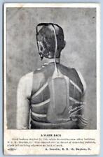 1907 DAYTON OHIO*SOUSLIN*BROKEN BACK*GROSSMAN PHOTO*MEDICAL DEVICE*NCR BUILDING picture