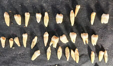 RARE Antique HUMAN TEETH w/ROOTS i-Tooth/Molar/Bicuspid or Inscisor Some Silver picture