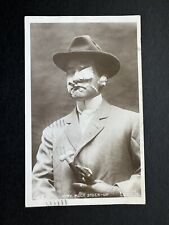 Postcard RPPC “VERY MUCH STUCK-UP” Man Face Covered Bandages Humor R67 picture