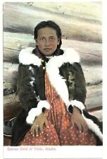 Teller, Alaska: Eskimo Child of Teller, ca 1909: Alaska Yukon Pacific Exposition picture