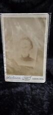 Antique cabinet card Of Women Will Deformed Skull Medical Oddities  picture