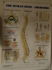 Wall Poster for Chiropractic Office, Human Spine Disorders picture