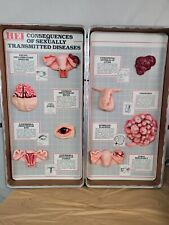 Health EdCo Consequences Of Sexually Transmitted Diseases Display Vintage picture