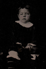 Antique Tintype Photo of Disabled Child with Deformed Eye picture
