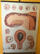 Original vintage medical pull down school chart of embryo child picture