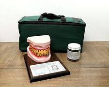 Health Edco Smokeless Tobacco Mouth Medical Model and Case picture